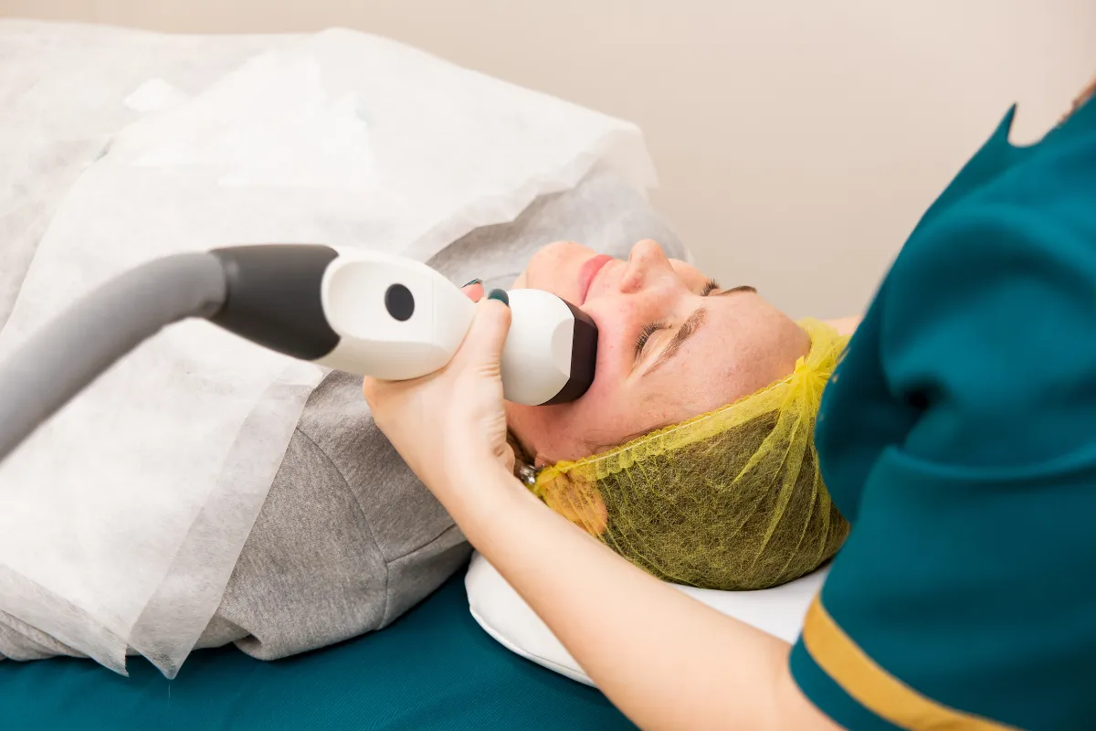 Dermal filler treatment