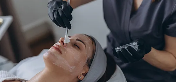 Chemical Peels